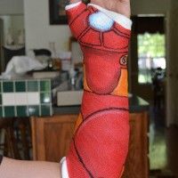 Tony Stark s'est cassé le bras! #IronMan